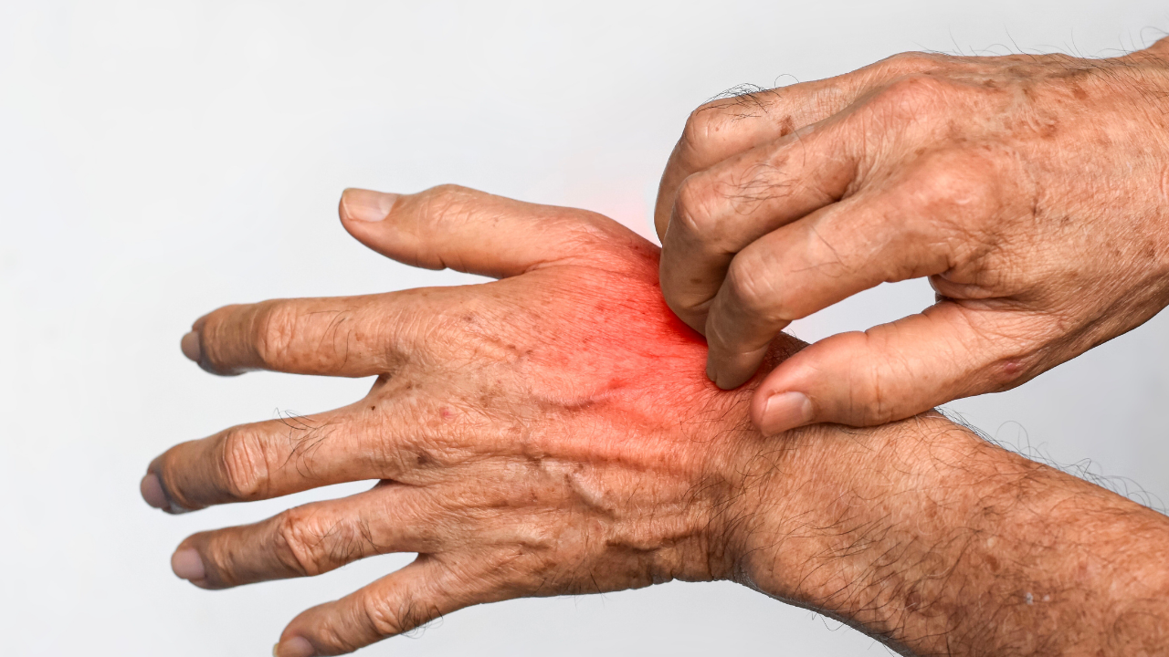 Soğuk Havalarda Artan 5 Cilt Hastalığına Dikkat! (1)