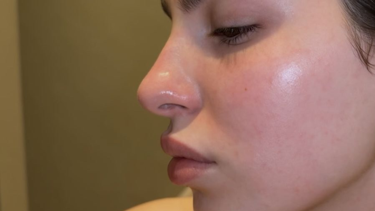 Yağlı Ciltler Için Bakım Rutini