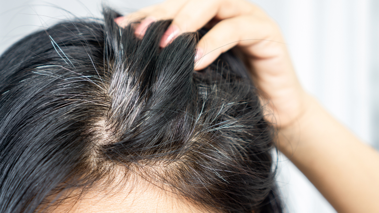 Bilim Saç Beyazlamasını Tersine Çevirebilir Mi İlk Bulgular Geldi (1)