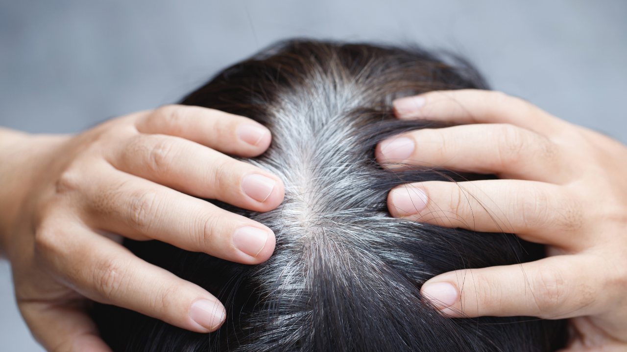 Bilim Saç Beyazlamasını Tersine Çevirebilir Mi İlk Bulgular Geldi (2)