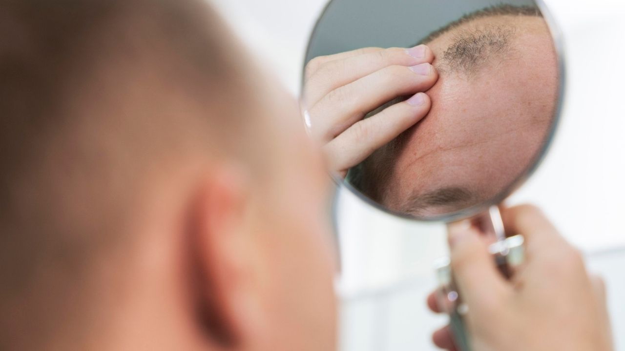 Clascoterone Kellik Tedavisi Uzman Yorumu (3)