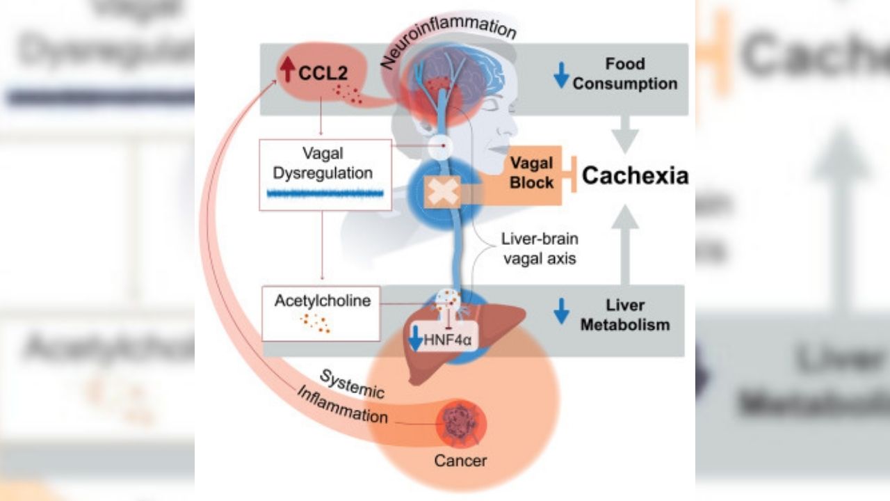 Kanser Tedavisinde Umut Veren Gelişme Kas Erimesini (Kaşeksi) Önleyen Akıllı Cilt Bandı (2)