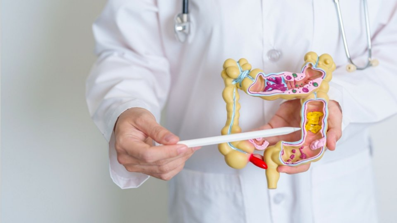 Murat Cemcir'in Hastalığı Divertikül Kanaması Nedir (2)