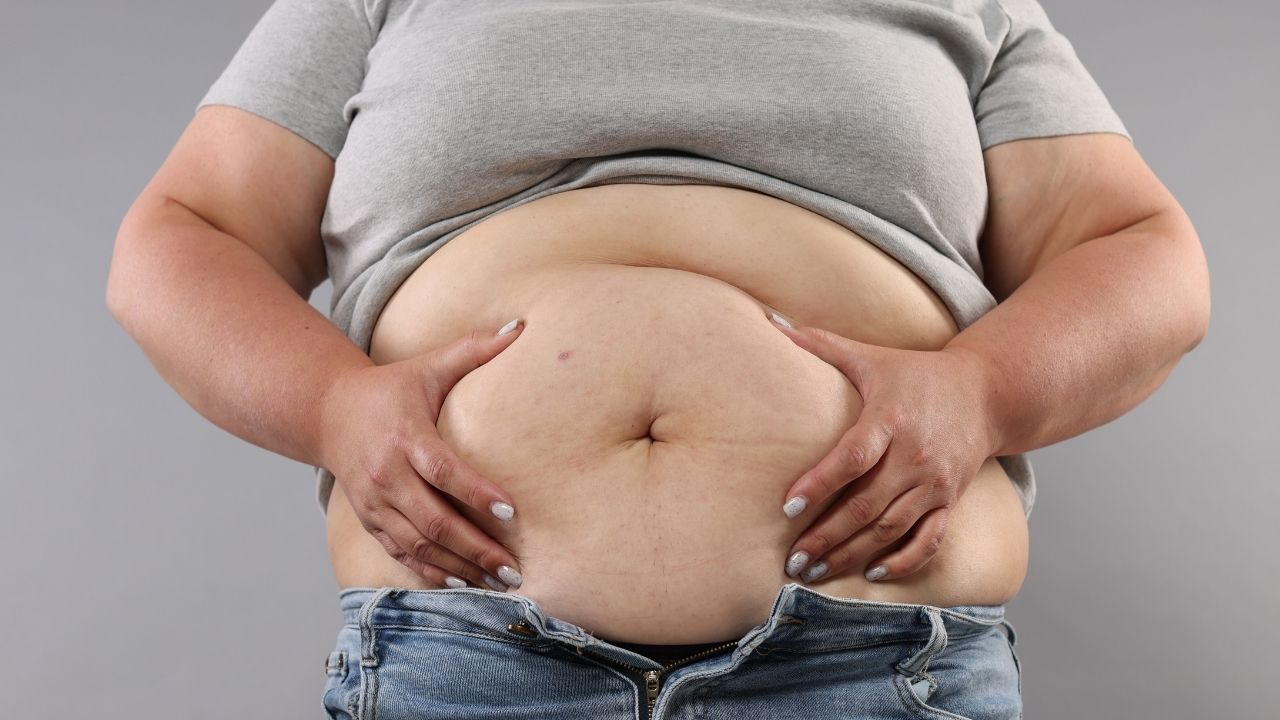 Tüp Mide Ameliyatının Zorlukları (2)