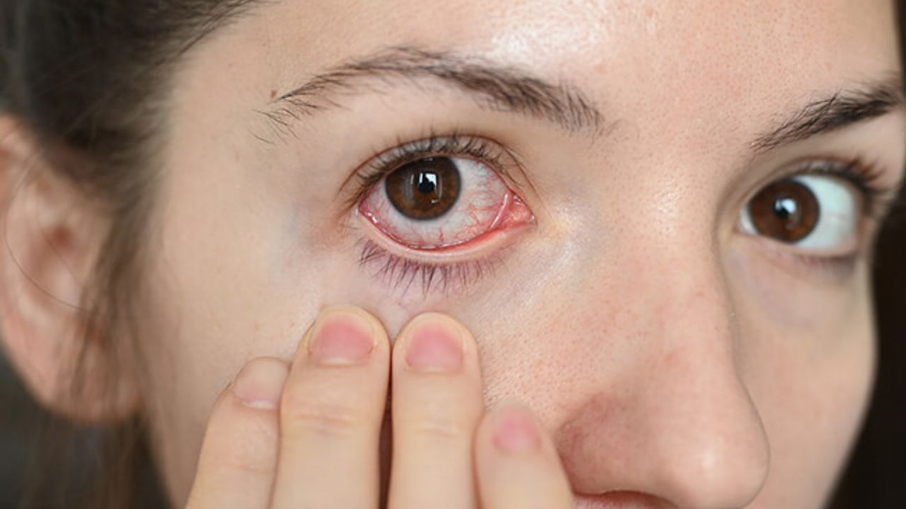 Gözler Sessizce Yoruluyor (3)