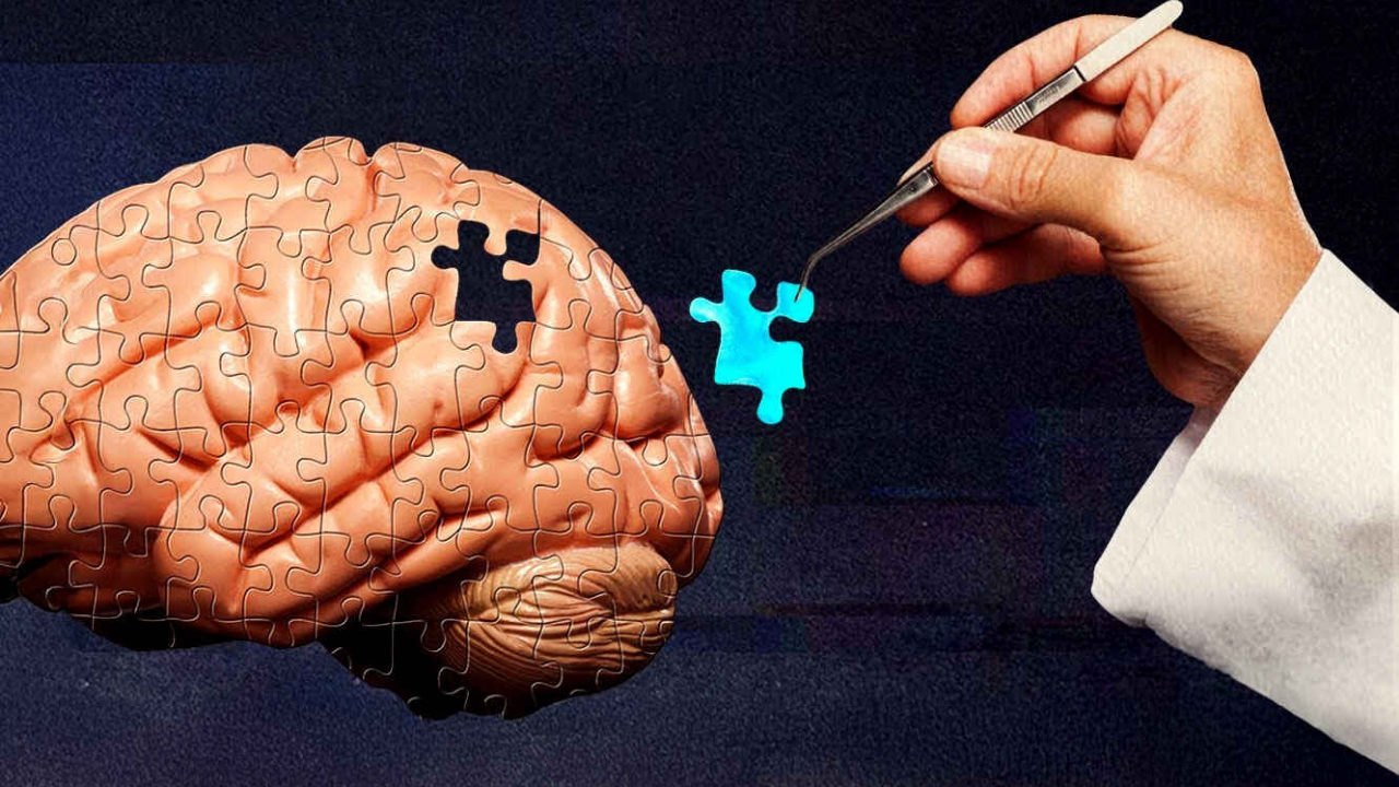 Her Şeyi Hatırlayamamamızın Şaşırtıcı Nedeni (2)