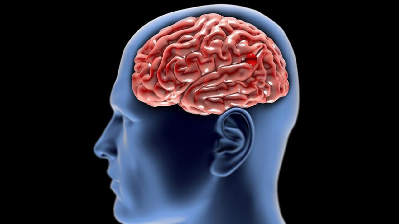 Nörologlar Uyarıyor Bu Içecek Beyin Performansını Artırıyor