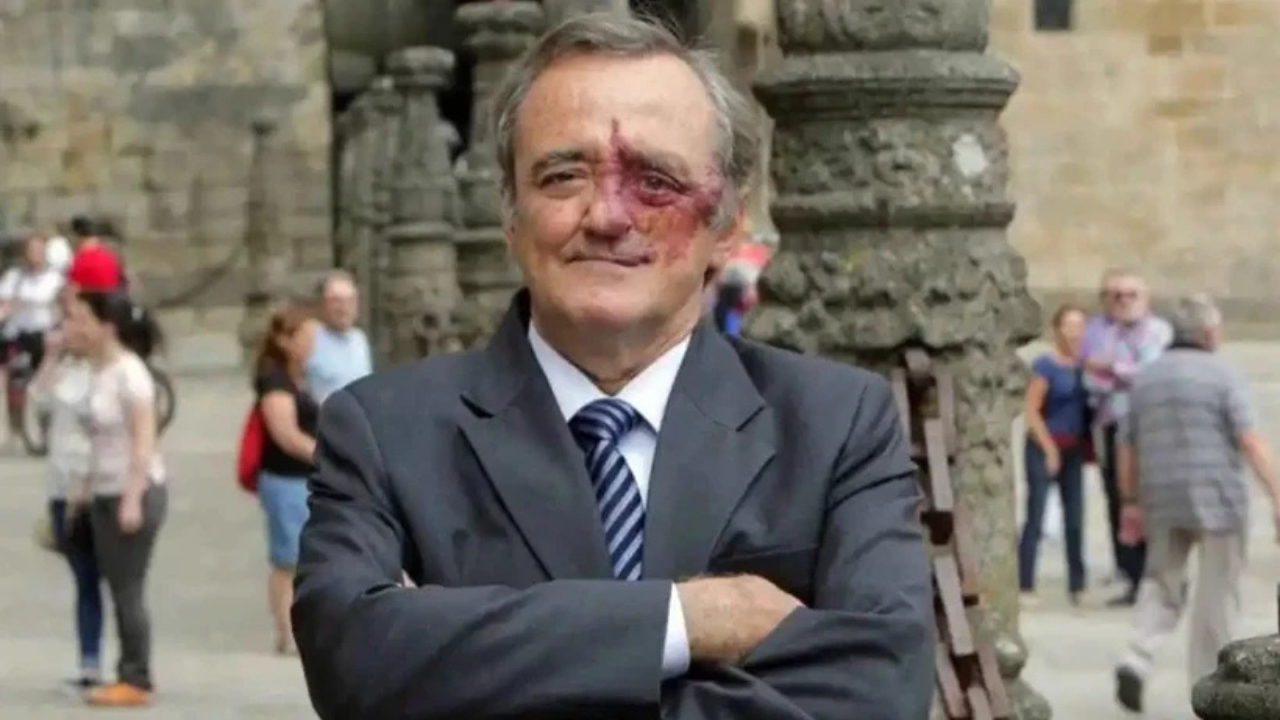 Pankreas Kanseri (4)