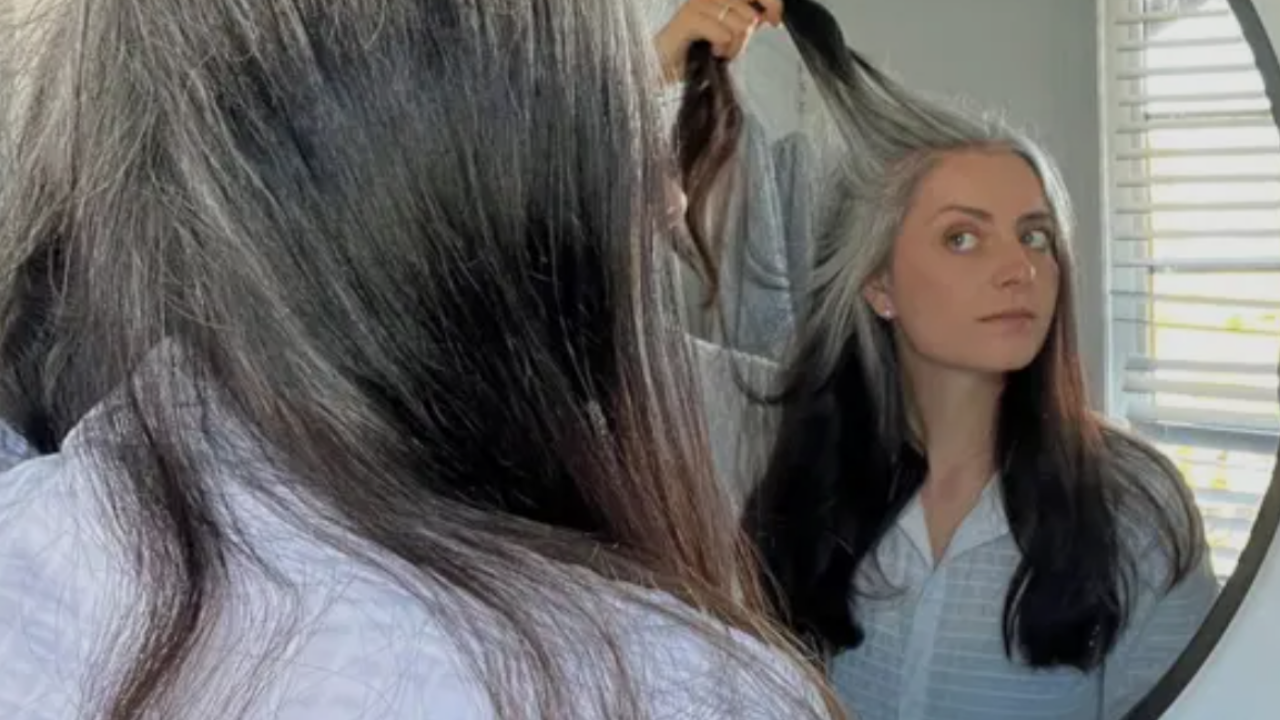 Saç Beyazlaması (3)