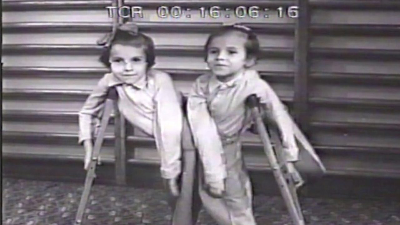 Yapışık Ikiz Deney 3