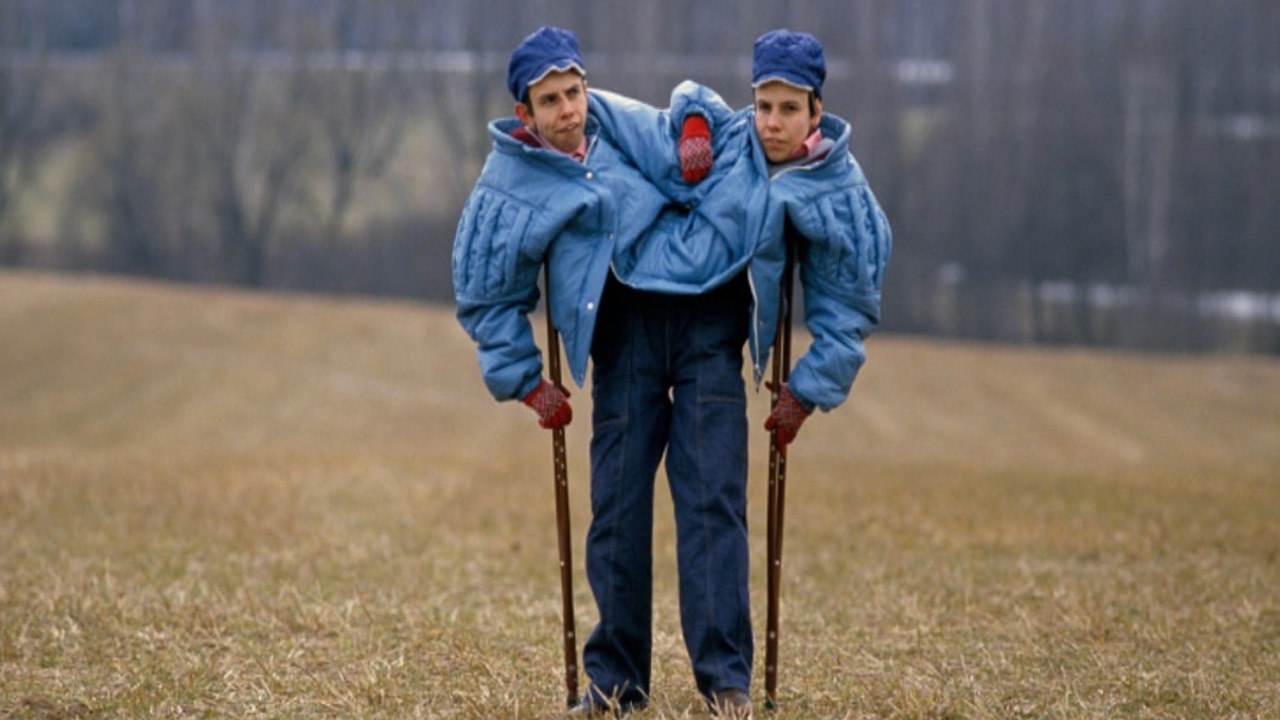 Yapışık Ikiz Deney 4-1