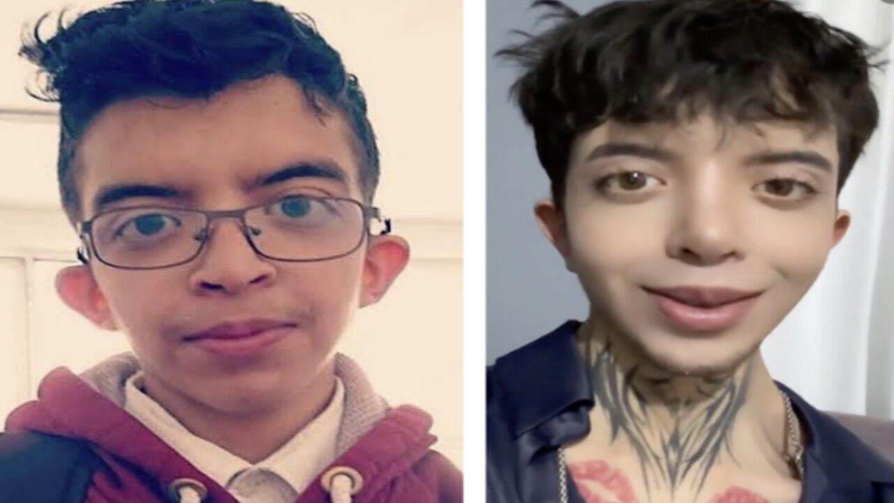 Tablet Reis Estetikle Bambaşka Birine Dönüştü Onurcan Güzel’in Hüzünlü Itirafı